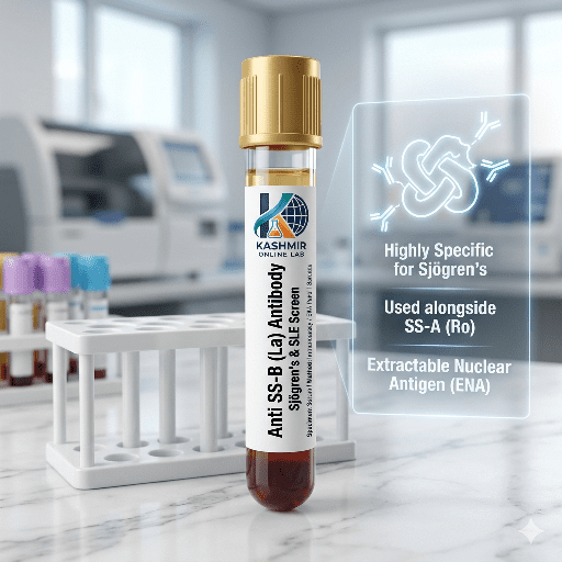Anti SS-B (La) Antibody Serum 4 406782
