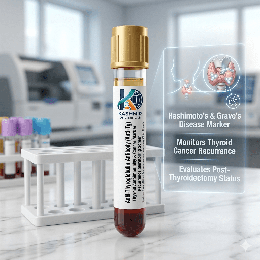 Anti-Thyroglobulin Antibody (Anti-Tg) 3 406784