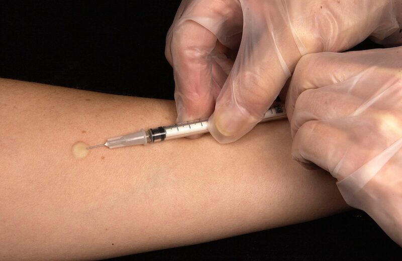 vaccination, tuberculin test, injection, splash, doctor, medicine, diagnosis, tuberculosis, disease, flu vaccination, immune system, vaccination, injection, tuberculosis, tuberculosis, tuberculosis, tuberculosis, tuberculosis