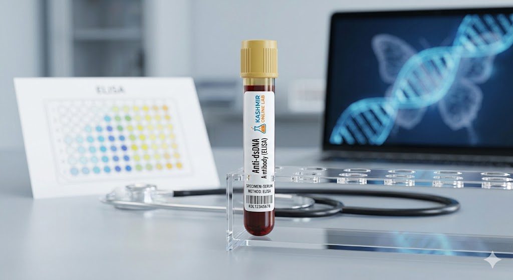 Anti Ds Dna Antibody Elisa 3 anti ds dna antibody elisa 1