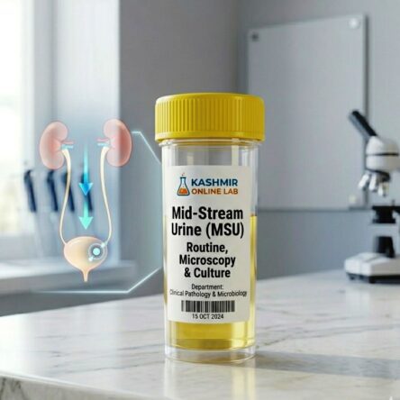 Mid-Stream Urine (MSU) – Routine, Microscopy & Culture