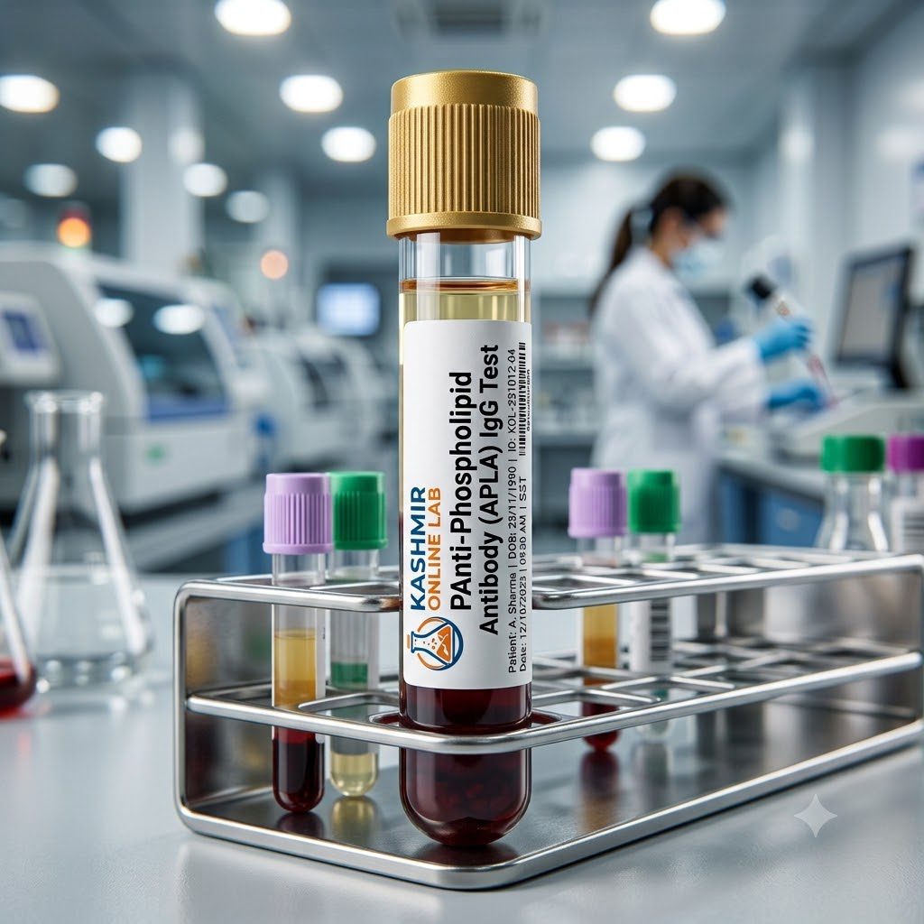 Anti-Phospholipid Antibody (APLA) IgG test 1 Anti-Phospholipid Antibody (APLA) IgG test