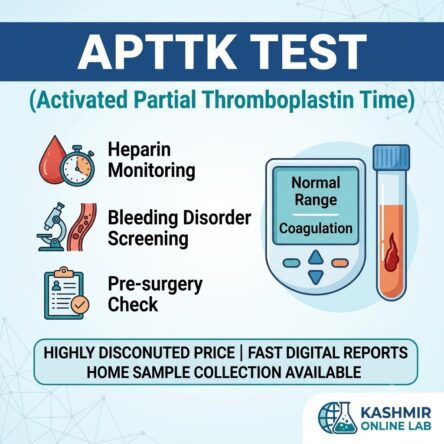 Activated Partial Thromboplastin Time (APTTK)