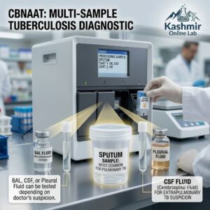 Cartridge Based Nucleic Acid Amplification Test (CBNAAT),