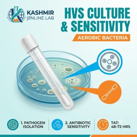 Test Culture & Sensitivity Aerobic Bacteria High Vaginal Swab (HVS)