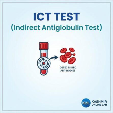 Indirect Coombs Test,