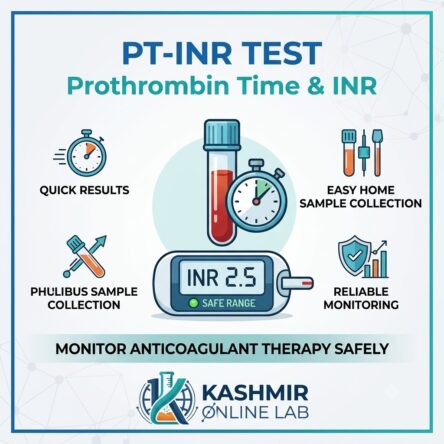 Prothrombin Time (PT) INR (International Normalized Ratio) Test