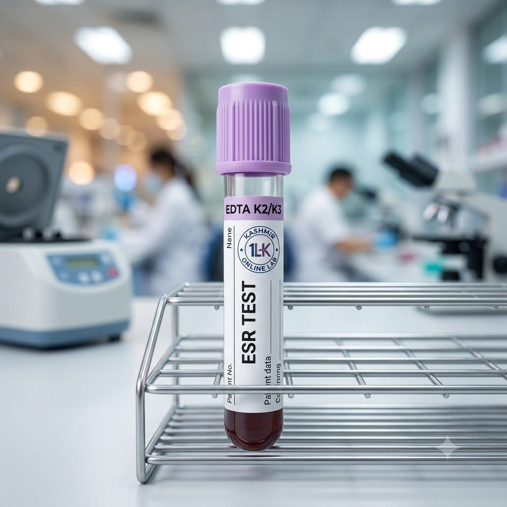 ESR (Erythrocyte Sedimentation Rate) Test 1 ESR (Erythrocyte Sedimentation Rate) Test
