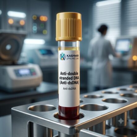 Anti dsDNA Test
