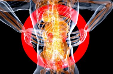 Chronic Muscle Pain