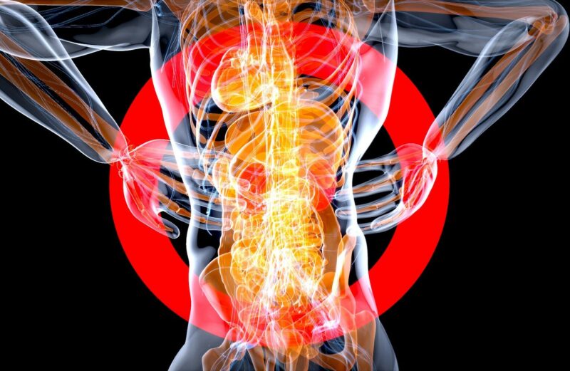 Chronic Muscle Pain
