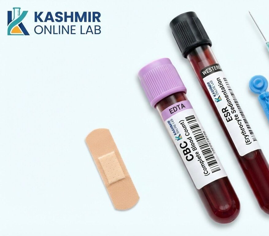 HEMOGRAM (CBC + ESR) 2 CBC ESR e1784875564615