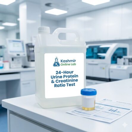 24H Protein Creatinine Ratio