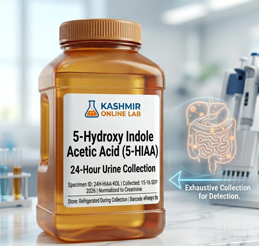 5-Hydroxy Indole Acetic Acid (5-HIAA)- Random Urine