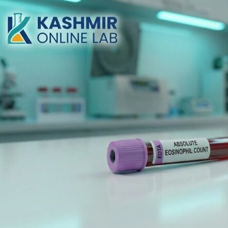 Absolute Eosinophil Count Blood