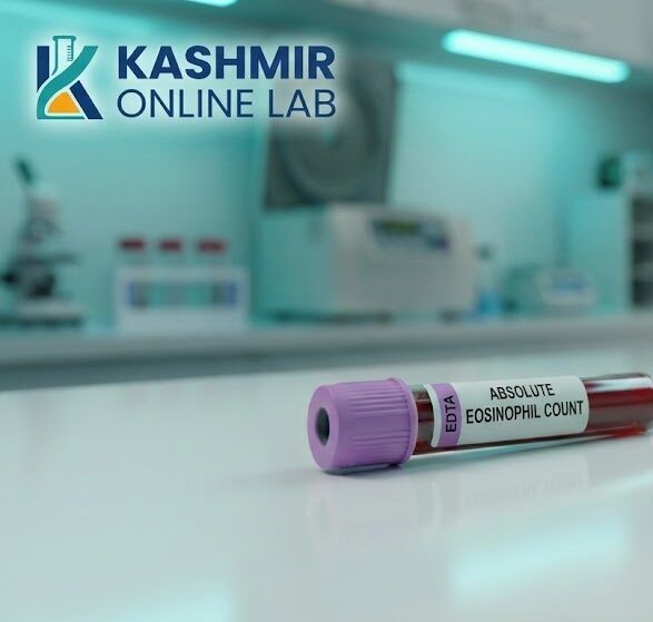 Absolute Eosinophil Count Blood 2 AEC e1781446890725