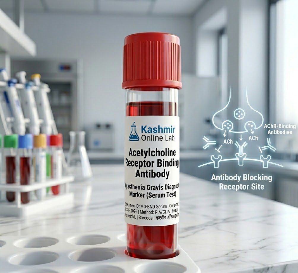 Acetylcholine Receptor Binding Antibody 7 Acetylcholine Receptor Binding Antibody Test e1781360215220