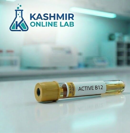 Active B12 5 Active B12 e1781446931272