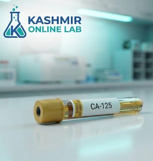 CA-125 Test