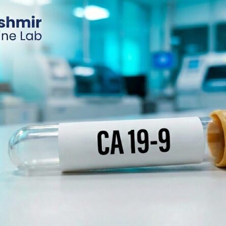 Ca19.9 (Pancreatic Cancer) – Cancer Markers