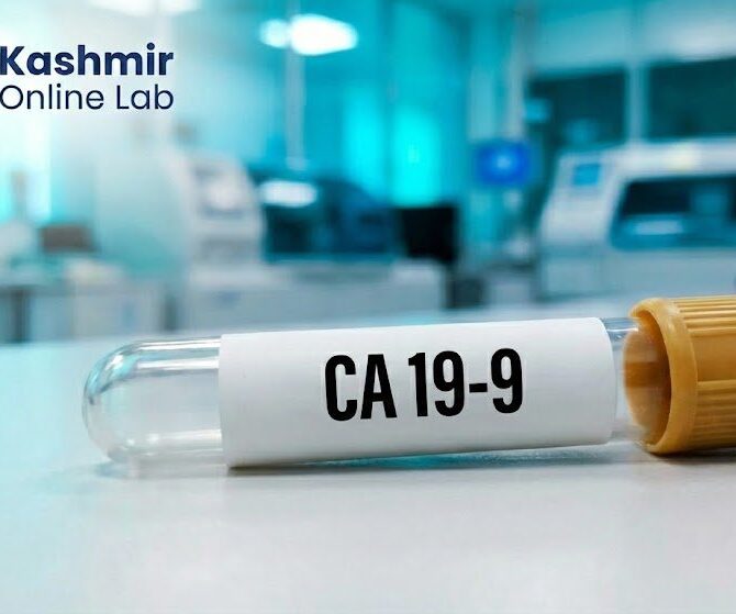 Ca19.9 (Pancreatic Cancer) - Cancer Markers 9 CA 19 9 1 e1783342937244