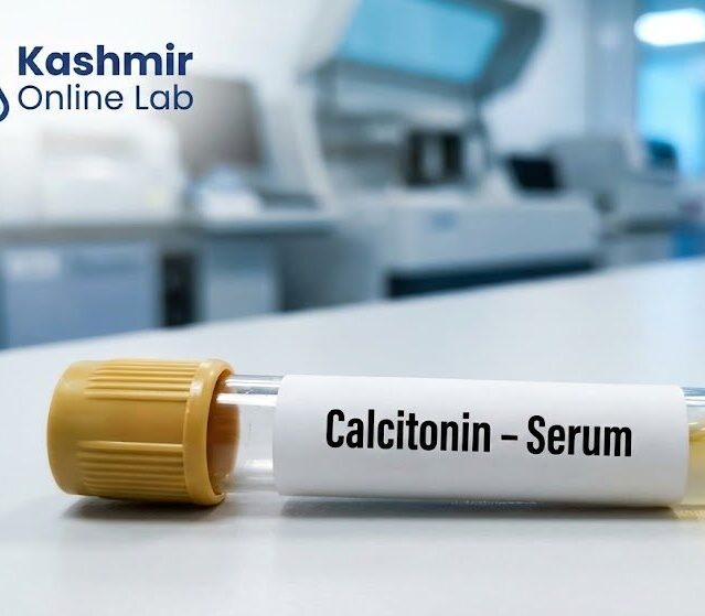 Calcitonin - Serum Test
