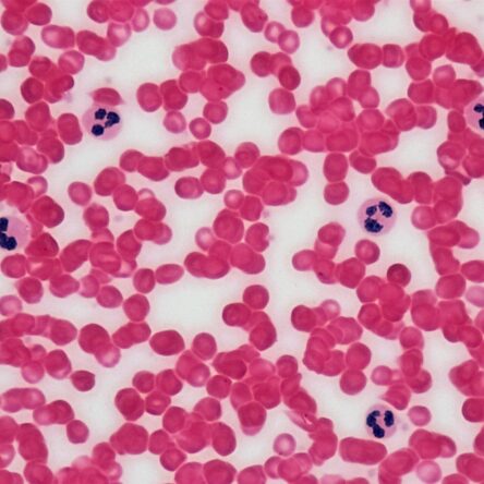 Blood Picture (P/S) Gbp