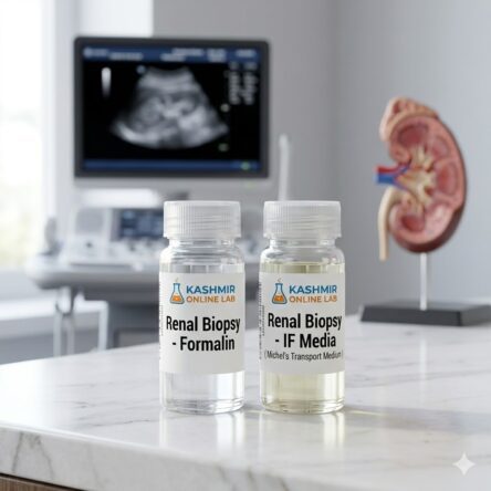 Biopsy-Kidney