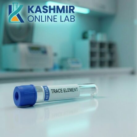 Cadmium – Urine Random