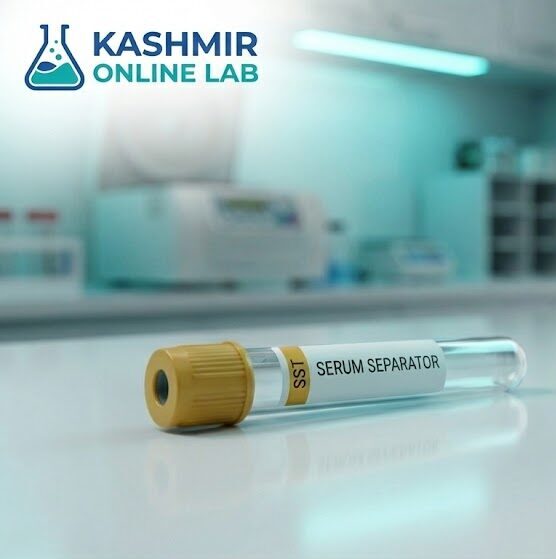 TORCH-4 IgM Panel, Serum (ELISA) 1 TORCH-4 IgM Panel, Serum (ELISA)