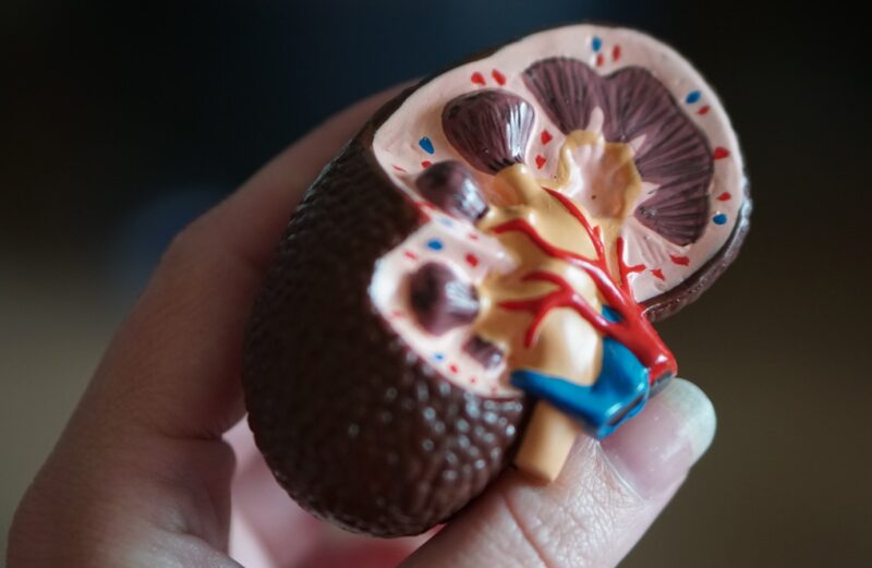 The “Dual-Threat” Marker: What Beta-2 Microglobulin Reveals About Cancer and Kidneys kidney scale model in hand