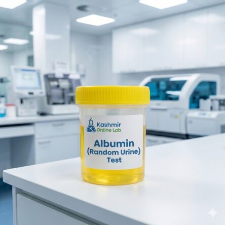 Albumin (Random Urine)