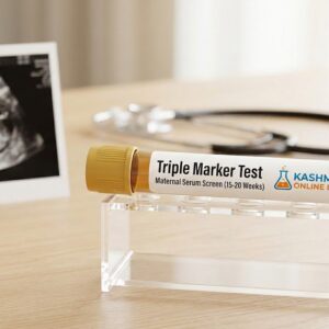 Triple Marker Test