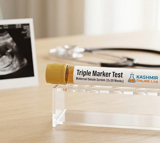 Triple Marker Test 1 Triple Marker Test