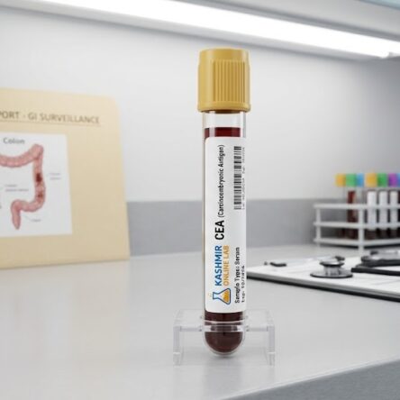 CEA (Carcinoembryonic Antigen) – Tumor Marker