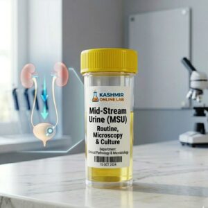 Mid-Stream Urine (MSU) - Routine, Microscopy & Culture